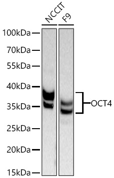 Western blot analysis of various lysates using OCT4 Rabbit  mAb at 1:5000 dilution incubated at room temperature for 1.5 hours.|Secondary antibody: HRP-conjugated Goat anti-Rabbit IgG (H+L) at 1:10000 dilution.|Lysates/proteins: 25 μg per lane.|Blocking buffer: 3% nonfat dry milk in TBST.|Detection: ECL Basic Kit.|Exposure time: 45s.