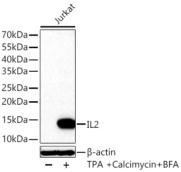 Western blot analysis of lysates from Jurkat cells using IL2 Rabbit mAb at 1:5000 dilution incubated at room temperature for 1.5 hours. Jurkat cells were treated with PMA/TPA (40 nM) ,Calcimycin (2 μM) and Brefeldin A (300 ng/ml) for 8 hours.|Secondary antibody: HRP-conjugated Goat anti-Rabbit IgG (H+L) at 1:10000 dilution.|Lysates/proteins: 25 μg per lane.| Blocking buffer: 3% nonfat dry milk in TBST.| Detection: ECL Basic Kit.| Exposure time: 60s.