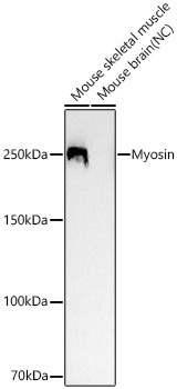 Western blot analysis of various lysates using Fast Myosin Skeletal Heavy chain Rabbit mAb at 1:12000 dilution incubated overnight at 4℃.|Secondary antibody: HRP-conjugated Goat anti-Rabbit IgG (H+L) at 1:10000 dilution.|Lysates/proteins: 25 μg per lane.|Blocking buffer: 3% nonfat dry milk in TBST.|Detection: ECL Basic Kit.|Negative control (NC): Mouse brain|Exposure time: 90s.