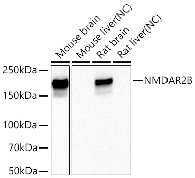 Western blot analysis of various lysates using NMDAR2B Rabbit mAb at 1:1000 dilution incubated overnight at 4℃.|Secondary antibody: HRP-conjugated Goat anti-Rabbit IgG (H+L) at 1:10000 dilution.|Lysates/proteins: 25 μg per lane.|Blocking buffer: 3% nonfat dry milk in TBST.|Detection: ECL Enhanced Kit.|Negative control (NC): Mouse liver,Rat liver|Exposure time: 5s.