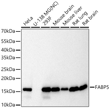 Western blot analysis of various lysates using FABP5 Rabbit mAb at 1:11000 dilution incubated at room temperature for 1.5 hours.|Secondary antibody: HRP-conjugated Goat anti-Rabbit IgG (H+L) at 1:10000 dilution.|Lysates/proteins: 25 μg per lane.|Blocking buffer: 3% nonfat dry milk in TBST.|Detection: ECL Basic Kit.|Negative control (NC): U-138 MG|Exposure time: 10s.