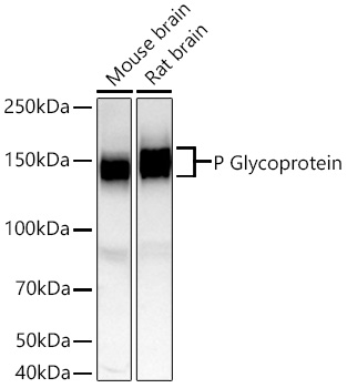 Western blot analysis of various lysates using P Glycoprotein Rabbit mAb at 1:1000 dilution incubated overnight at 4℃.|Secondary antibody: HRP-conjugated Goat anti-Rabbit IgG (H+L) at 1:10000 dilution.|Lysates/proteins: 25 μg per lane.|Blocking buffer: 3% nonfat dry milk in TBST.|Detection: ECL Basic Kit.|Exposure time: 60s.
