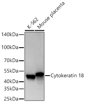 Western blot analysis of various lysates using Cytokeratin 18 Rabbit mAb at 1:12000 dilution incubated overnight at 4℃.|Secondary antibody: HRP-conjugated Goat anti-Rabbit IgG (H+L) at 1:10000 dilution.|Lysates/proteins: 25 μg per lane.|Blocking buffer: 3% nonfat dry milk in TBST.|Detection: ECL Basic Kit.|Exposure time: 10s.