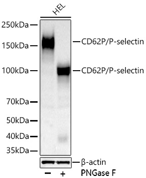 Western blot analysis of lysates from HEL cells using CD62P/P-selectin Rabbit mAb at 1:5000 dilution incubated overnight at 4℃. HEL cells were treated with PNGase F (1 μL) at 37℃ for 30 minutes.|Secondary antibody: HRP-conjugated Goat anti-Rabbit IgG (H+L) at 1:10000 dilution.|Lysates/proteins: 30 μg per lane.| Blocking buffer: 3 % nonfat dry milk in TBST.| Detection: ECL Basic Kit.| Exposure time: 90s.