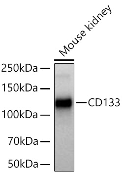 Western blot analysis of lysates from Mouse kidney using CD133 Rabbit mAb at 1:5000 dilution incubated at room temperature for 1.5 hours.|Secondary antibody: HRP-conjugated Goat anti-Rabbit IgG (H+L) at 1:10000 dilution.|Lysates/proteins: 25 μg per lane.|Blocking buffer: 3% nonfat dry milk in TBST.|Detection: ECL Basic Kit.|Exposure time: 5s.