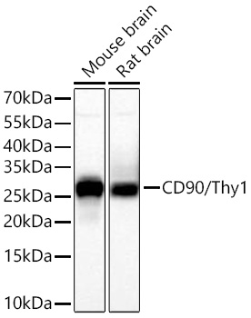 Western blot analysis of various lysates using CD90/Thy1 Rabbit mAb at 1:42000 dilution incubated overnight at 4℃.|Secondary antibody: HRP-conjugated Goat anti-Rabbit IgG (H+L) at 1:10000 dilution.|Lysates/proteins: 25 μg per lane.|Blocking buffer: 3% nonfat dry milk in TBST.|Detection: ECL Basic Kit.|Exposure time: 10s.