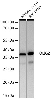 Western blot analysis of various lysates using OLIG2 Rabbit mAb at 1:5000 dilution incubated overnight at 4℃.|Secondary antibody: HRP-conjugated Goat anti-Rabbit IgG (H+L) at 1:10000 dilution.|Lysates/proteins: 25 μg per lane.|Blocking buffer: 3% nonfat dry milk in TBST.|Detection: ECL Basic Kit.|Exposure time: 10s.