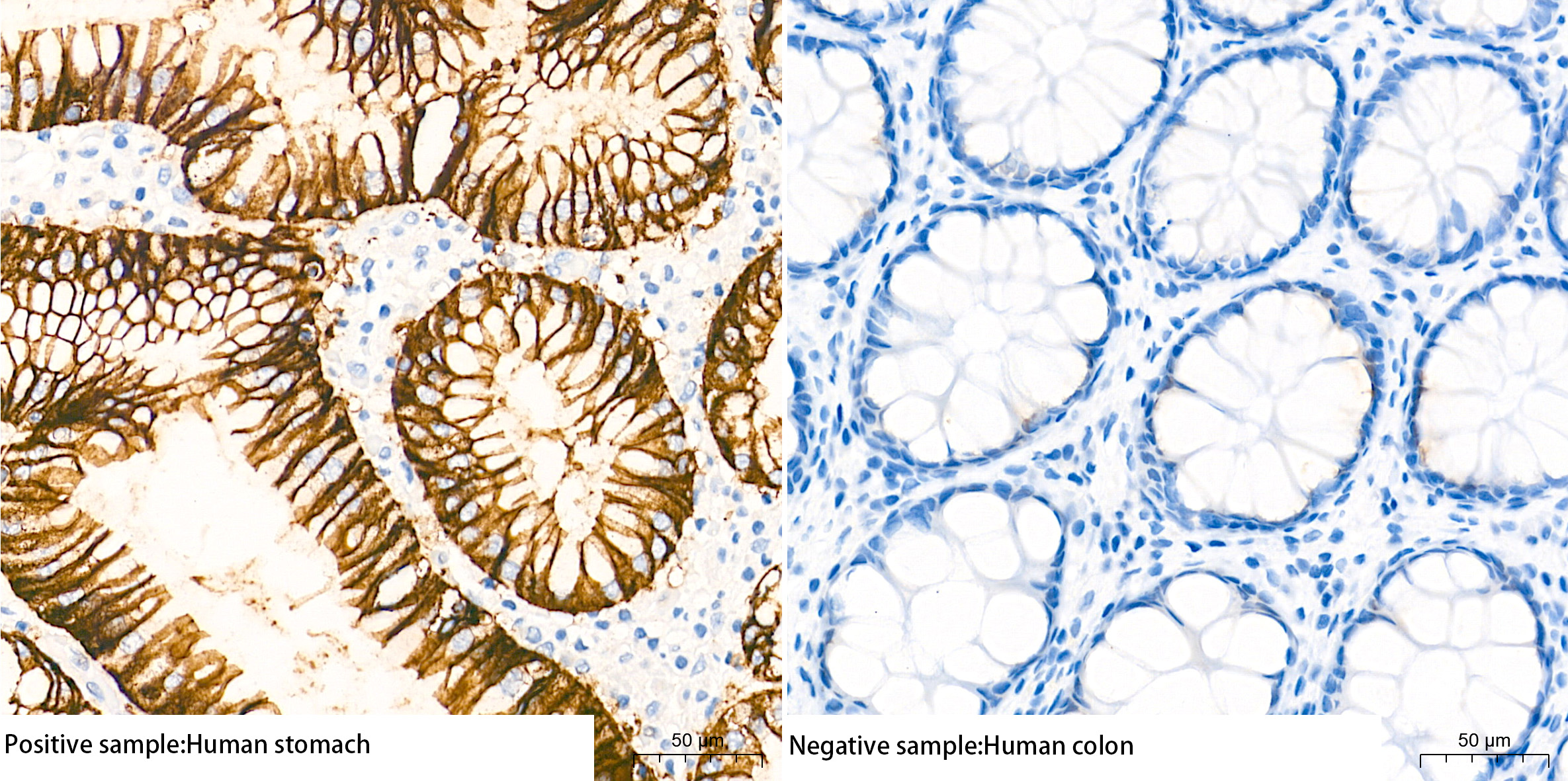 Immunohistochemistry analysis of paraffin-embedded Human stomach(positive sample) and Human colon(negative sample) tissue using Claudin18.2 Rabbit mAb at a dilution of 1:1000 (40x lens). High pressure antigen retrieval performed with 0.01M Tris-EDTA Buffer (pH 9.0) prior to IHC staining.