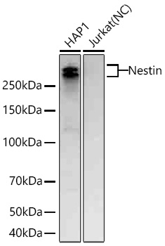 Western blot analysis of various lysates using Nestin Rabbit mAb at 1:5000 dilution incubated overnight at 4℃.|Secondary antibody: HRP-conjugated Goat anti-Rabbit IgG (H+L) at 1:10000 dilution.|Lysates/proteins: 25 μg per lane.|Blocking buffer: 3% nonfat dry milk in TBST.|Detection: ECL Basic Kit.|Negative control (NC): Jurkat|Exposure time: 20s.