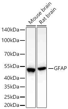 Western blot analysis of various lysates using GFAP Rabbit mAb at 1:5000 dilution incubated overnight at 4℃.|Secondary antibody: HRP-conjugated Goat anti-Rabbit IgG (H+L) at 1:10000 dilution.|Lysates/proteins: 25 μg per lane.|Blocking buffer: 3% nonfat dry milk in TBST.|Detection: ECL Basic Kit.|Exposure time: 45s.