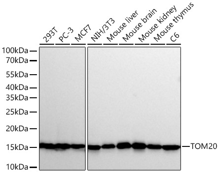 Western blot analysis of various lysates using TOM20 Rat mAb at 1:6000 dilution incubated overnight at 4℃.|Secondary antibody: HRP-conjugated Goat anti-Rat IgG (H+L) at 1:10000 dilution.|Lysates/proteins: 25 μg per lane.|Blocking buffer: 3% nonfat dry milk in TBST.|Detection: ECL Basic Kit.|Exposure time: 30s.