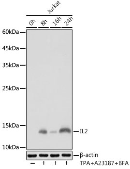 Western blot analysis of lysates from Jurkat cells, using IL2 Rabbit mAb at 1:1000 dilution. Jurkat cells were treated with TPA (40 nM),A23187 (2μM) and Brefeldin A (300 ng / ml) for 0-24hours.|Secondary antibody: HRP-conjugated Goat anti-Rabbit IgG (H+L) at 1:10000 dilution.|Lysates/proteins: 25μg per lane.|Blocking buffer: 3% nonfat dry milk in TBST.|Detection: ECL Basic Kit.|Exposure time: 10s.